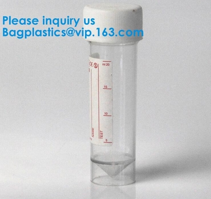 Muestra disponible estéril 60ml 100 del hospital envase de la taza del colector de la orina de la colección de la medida de la prueba de 120 ml
